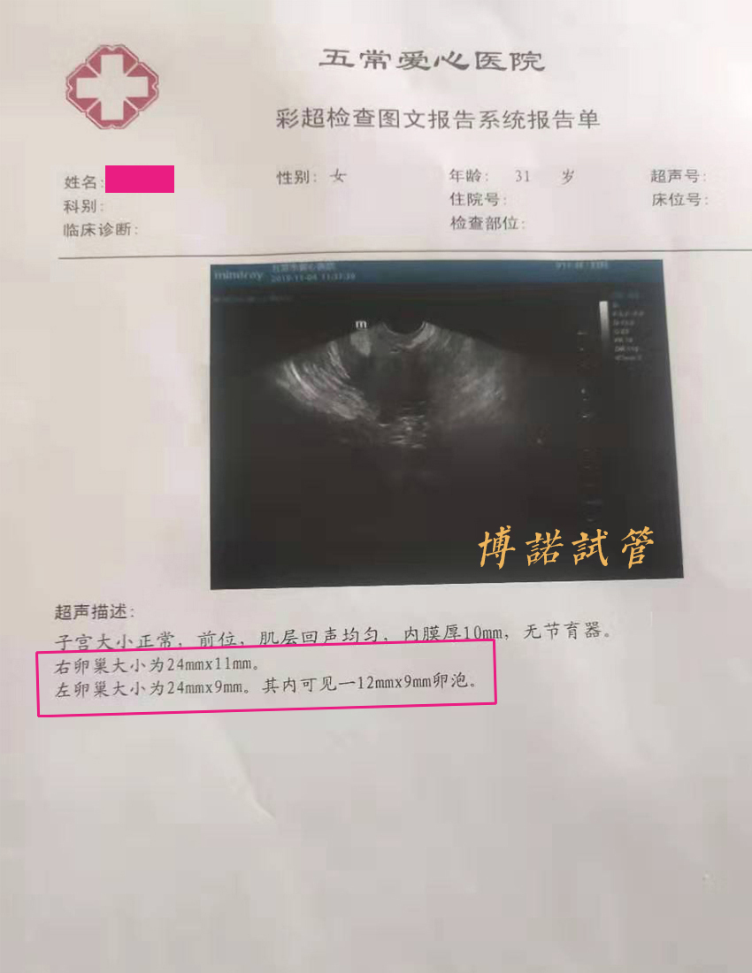 新加坡代孕流程.jpg