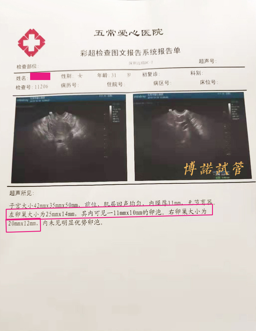 新加坡代孕妈妈.jpg