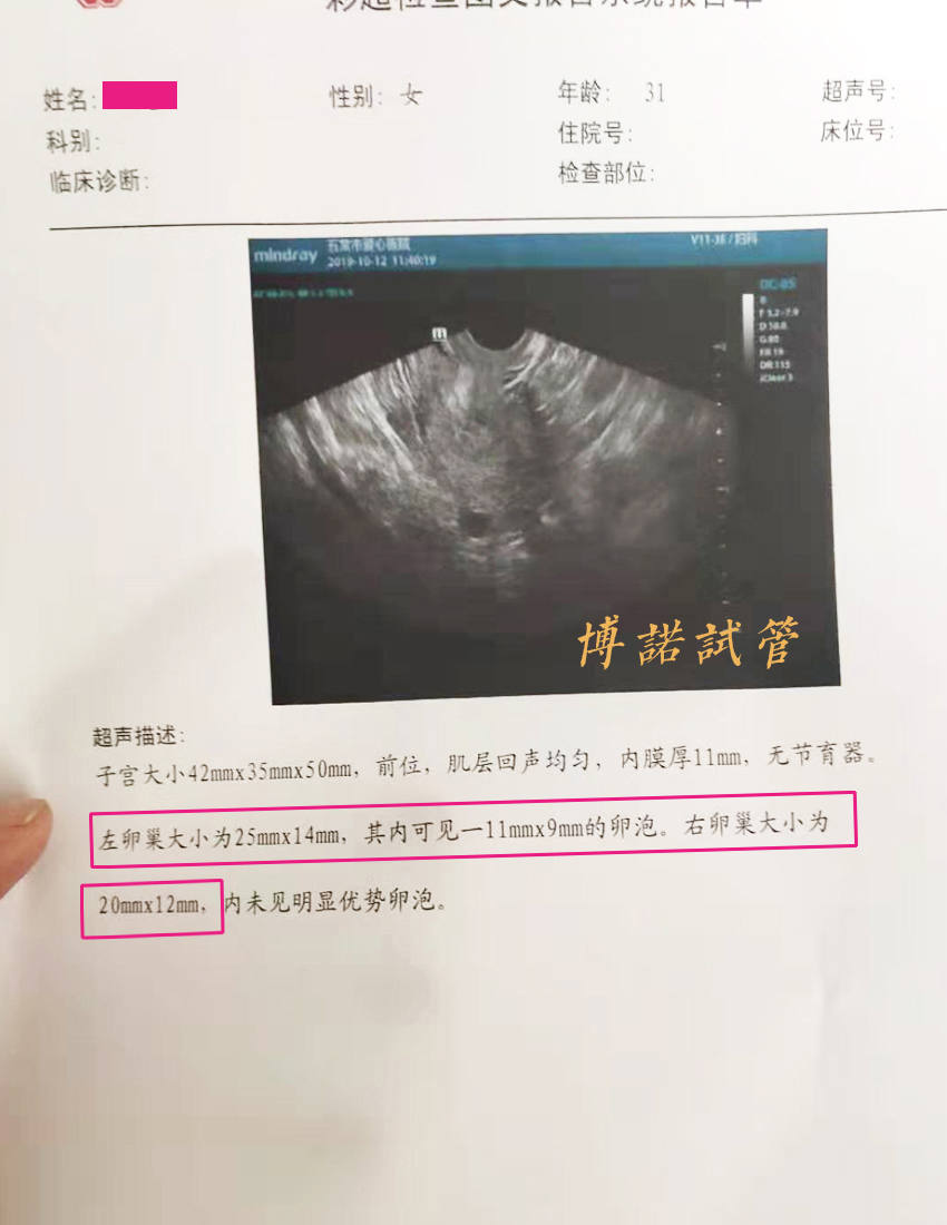 新加坡代孕中介.jpg