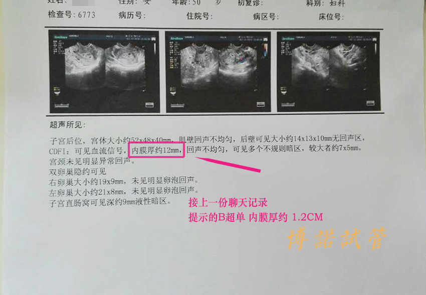 新加坡代孕价格.jpg