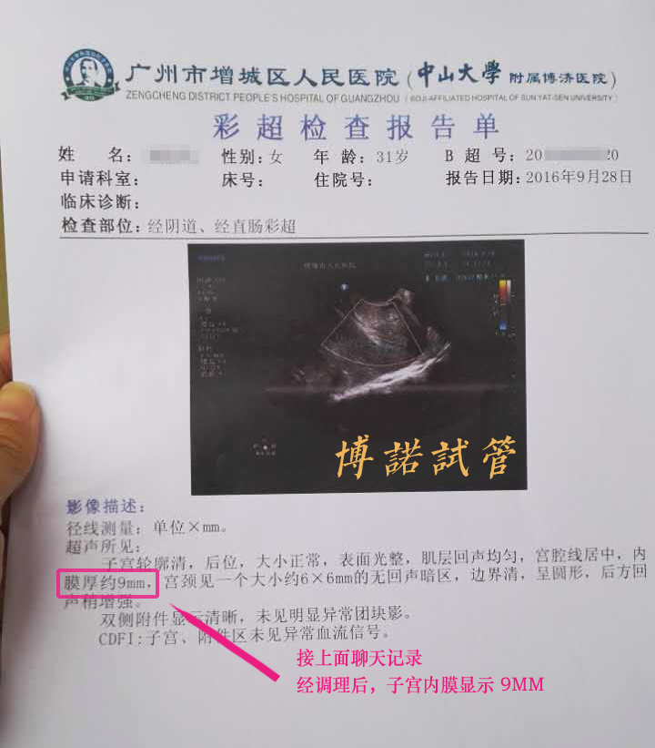 新加坡代孕风险.jpg