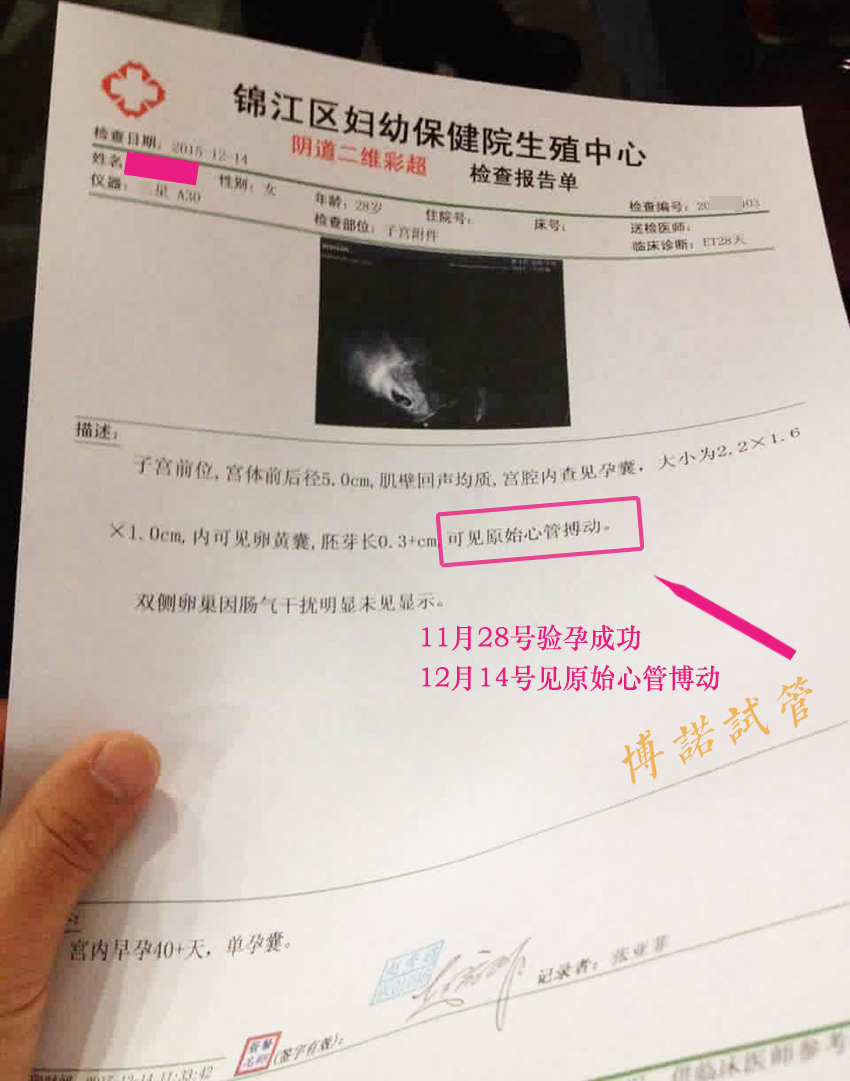 新加坡代孕成功率高.jpg
