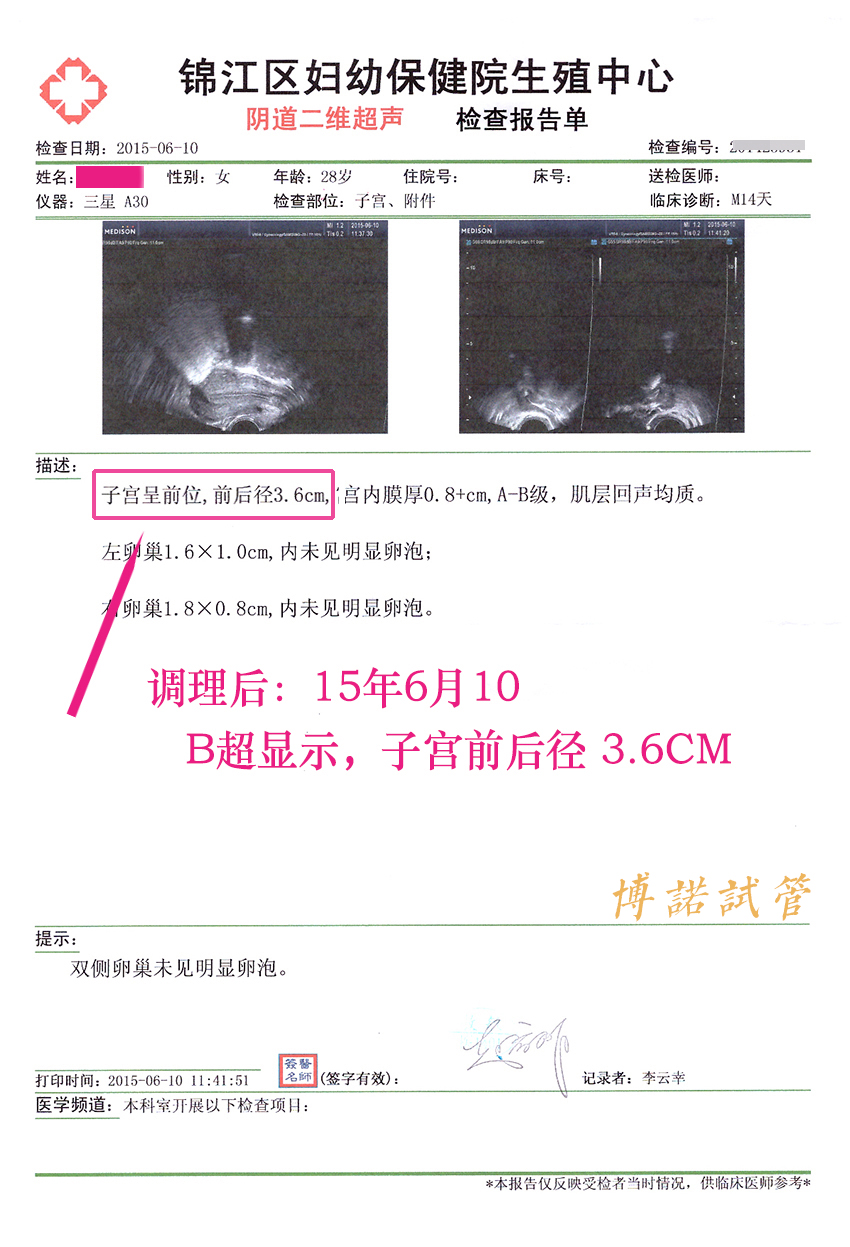 新加坡代孕妈妈条件.jpg